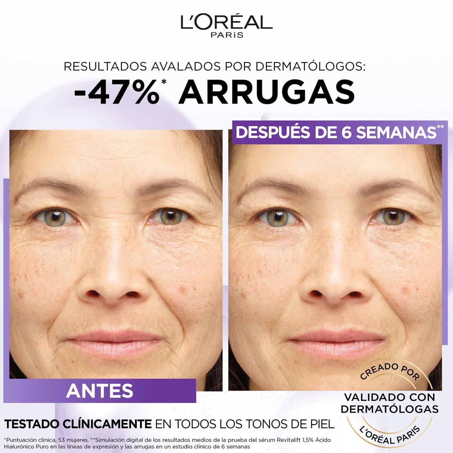 L'Oréal Paris Sérum Antiedad Revitalift Filler (+ Ácido Hialurónico Puro), 30 ml